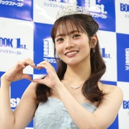 元日向坂46・宮田愛萌、腫れた顔をSNS公開！「そんなに腫れるの？」とファンも驚愕