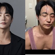 「性病をうつされ暴力もあった」と告発された韓国俳優が反論「彼女に殴られた」