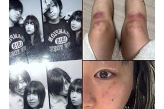 “デートDV被害”を暴露→立場を翻した韓国女性ラッパー、加害者と指名した元恋人と復縁を示唆 画像