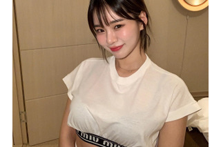 “韓国で最もグラマラス”な元芸人が12年ぶりに整形　手術1カ月後の顔を公開「満足度は…」 画像