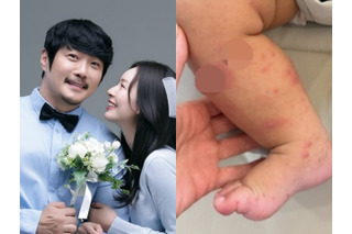 韓国人夫のために日本国籍を捨てた女性、生後8カ月の息子が手足口病に「先輩ママの話が聞きたい」 画像