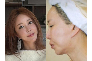 横浜で生まれ育った元韓国トップアイドル、自身もショックを受けた外見の変化「私の顔どうした」 画像