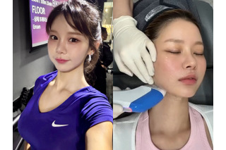 “韓国で最もグラマラス”と言われた元芸人、医師の年下彼氏に顔をお任せ！美容施術VLOGが話題 画像
