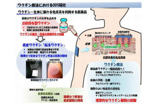 貼るインフルエンザワクチン、5年後実用化へ 画像