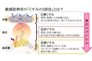 シミを目立たせる、敏感肌特有の「くすみの3原色」を発見 画像