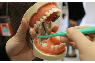 むし歯予防関連製品について歯科衛生士に聞く…『第7回 ワールドデンタルショー2014』 画像