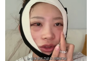 まるで“顔面フルリフォーム”…急逝した元巨人投手・国民的女優が両親 韓国インフルエンサーが大規模整形 画像