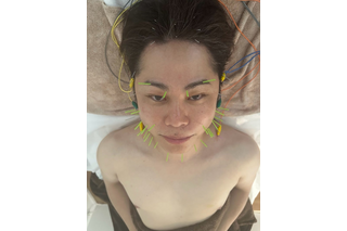 「こわっ!」ノンスタ井上、美容施術中のショット公開し反響 画像