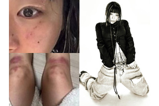 ボコボコに殴られたような写真はなんだったのか…元恋人のDV疑惑を提起した韓国女性ラッパー、立場を翻す 画像
