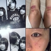 “デートDV被害”を暴露→立場を翻した韓国女性ラッパー、加害者と指名した元恋人と復縁を示唆