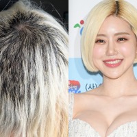 髪の90%が抜け落ち“対人恐怖症”にもなったDJ SODA、ブリーチ事故から1年…最新の髪型公開