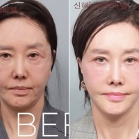 限界ギリギリまで整形、60代とは思えないビジュアルに！韓国ベテラン女優の潔すぎる告白が話題