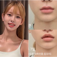 12年ぶりの整形は人中短縮「ママには内緒で」“韓国で最もグラマラス”な元芸人（40）が理由明かす