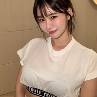 “韓国で最もグラマラス”な元芸人が12年ぶりに整形　手術1カ月後の顔を公開「満足度は…」