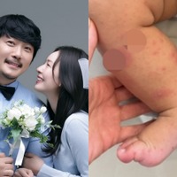 韓国人夫のために日本国籍を捨てた女性、生後8カ月の息子が手足口病に「先輩ママの話が聞きたい」