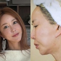 横浜で生まれ育った元韓国トップアイドル、自身もショックを受けた外見の変化「私の顔どうした」