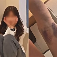 ストーカー被害の末に転落死…加害者姉のドラマ出演めぐり放送局が公式回答、遺族との“ズレ”露呈