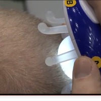 頭皮の状態をセルフチェック、頭皮拡大デモUSBカメラのデモ動画 画像