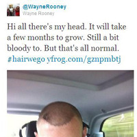 イングランド代表FWルーニーが植毛した姿を公開「これが俺の頭だ」 画像