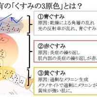 シミを目立たせる、敏感肌特有の「くすみの3原色」を発見 画像