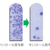 キシリトールを投与する前（左）と投与後（右）に、ミュータンス菌検査キット「デントカルトSM」で検査をした結果