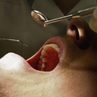 むし歯治療のイメージ　写真提供：Getty Images