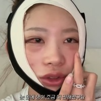 まるで“顔面フルリフォーム”…急逝した元巨人投手・国民的女優が両親　韓国インフルエンサーが大規模整形