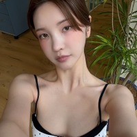 “パク・ソジュンとの熱愛説”で一躍時の人に、韓国美女ユーチューバーが流行りの歯科施術を報告