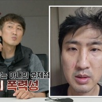 妻のDVで夫の眼球は破裂寸前に…“10カ月スピード婚”の韓国夫婦に起こった悲劇「離婚した方がいい」