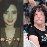 整形手術の副作用で苦しんだ「扇風機おばさん」、7周忌　死因は未だに不明のまま