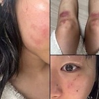 顔は腫れ脚には痣…韓国女性ラッパーがDV被害を暴露、お相手は元恋人の音楽P　食い違う主張