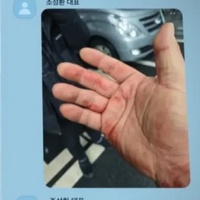 暴行の跡まで!! Ｊリーグのパワハラ問題に匹敵するか。韓国“ランシュー界の帝王”パワハラ事件の真相はいかに