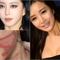 整形に美容施術、もはや“美”は金で買う時代　その裏に潜むリスクに直面した韓国芸能人たち