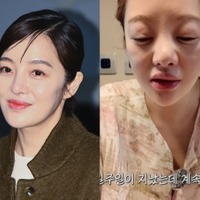別人級に腫れた顔…『キム秘書』女優ファン・ボラ（42）、体外受精の副作用で健康悪化「体はボロボロ」