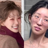 元巨人投手の父を持つ韓国インフルエンサー、衝撃のすっぴんを公開…過去に整形中の顔も披露