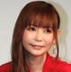 中川翔子、指輪が抜けず薬指がうっ血「ああバカ」紫に変色した指に「救外行って」と心配の声 画像
