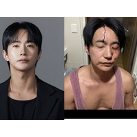 「性病をうつされ暴力もあった」と告発された韓国俳優が反論「彼女に殴られた」
