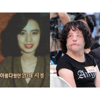 美女がなぜ“扇風機おばさん”に？死去の秘話が明かされる…違法整形、顔に工業用シリコンを注入