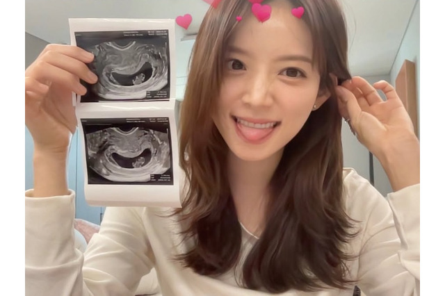 「夫と一緒にシャワー」発言に賛否…授かり婚の韓国インフルエンサー、番組演出に理解求める 画像