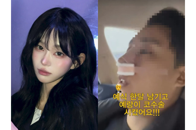 “整形モンスター”と自身も認めた韓国インフルエンサー、婚約者にも整形をさせる 亡き父は元巨人投手 画像