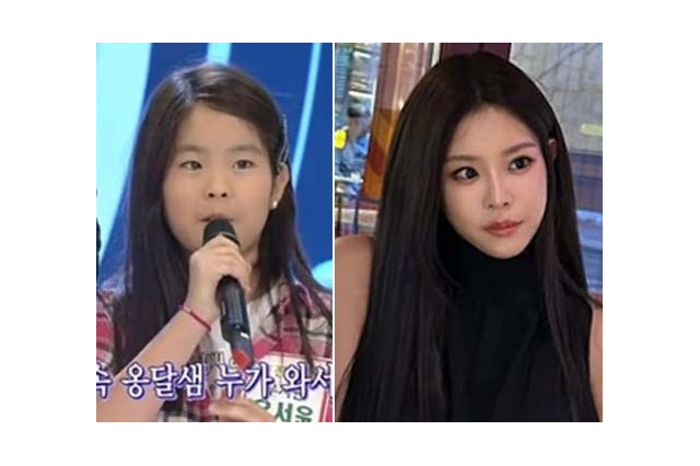 韓国ミスコン優勝者に整形疑惑、有名人の娘を巡って議論沸騰　令和の「競い方」の在り方 画像