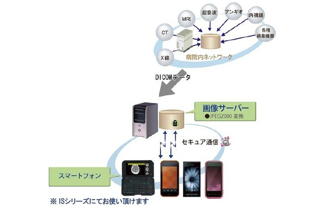 KDDI研、au ISシリーズを活用する医療用画像伝送システム「SmartMIMAS」発売 画像