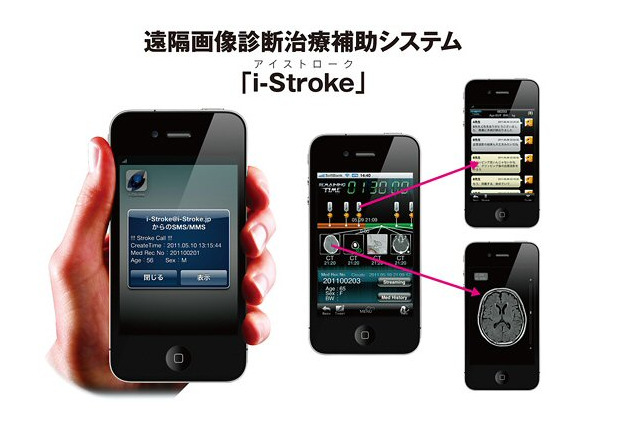 富士フイルム、スマートフォンで脳卒中患者の救急医療をサポート 画像
