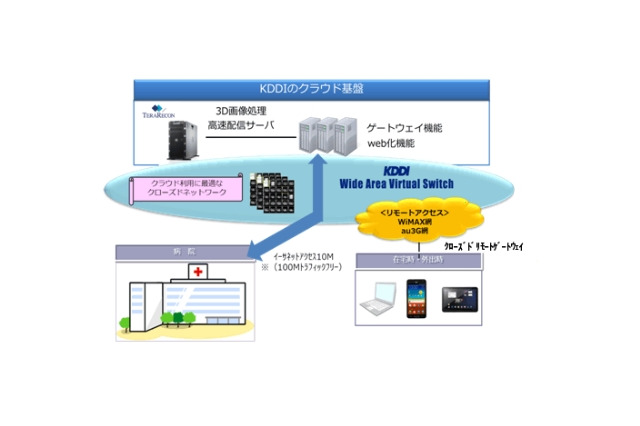 KDDIと米テラリコン、クラウド型「リアルタイム3D医用画像ソリューション」提供開始 画像