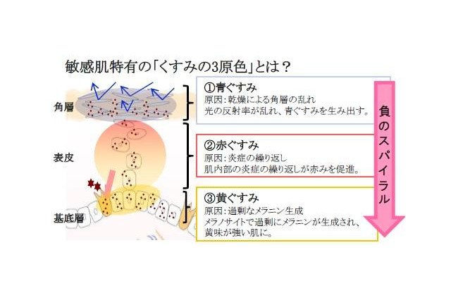 シミを目立たせる、敏感肌特有の「くすみの3原色」を発見 画像