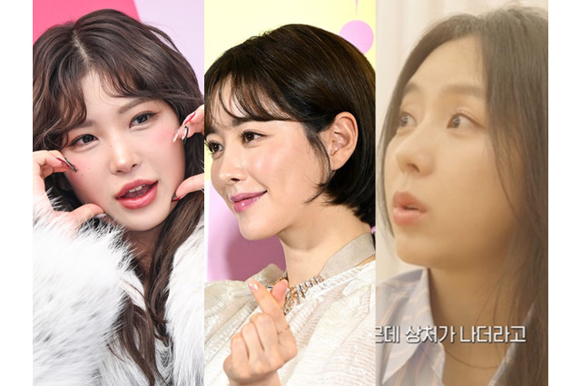「鼻先を少し上げた」と整形手術を明かす元K-POPアイドル…“顔は全部”から“胸の手術”まで告白する韓国スターたち 画像