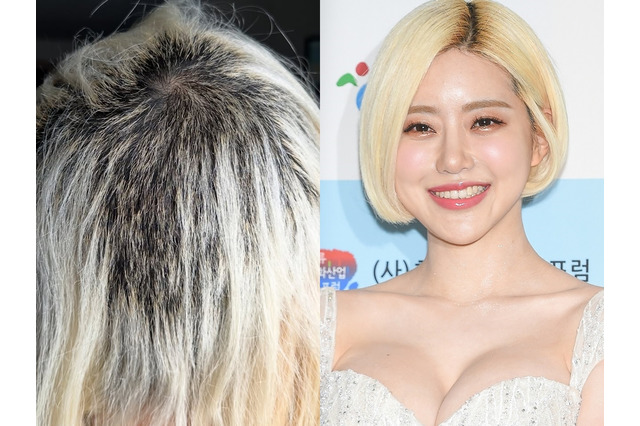 日本を騒がせたDJ SODAが見るも無残な姿に、一体何が？「どんどん抜けて…」大阪のイベントでのセクハラ被害で話題に 画像