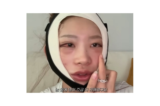 まるで“顔面フルリフォーム”…急逝した元巨人投手・国民的女優が両親 韓国インフルエンサーが大規模整形 画像