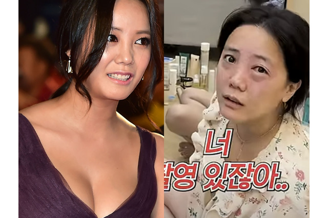 顔面トラブル続きの韓国女優、今度は異常な目の腫れに困惑「撮影直前に緊急事態」 画像