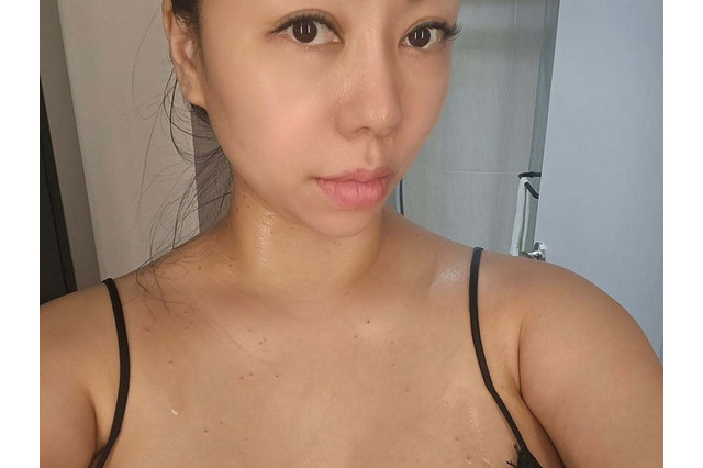 胸元大胆ドレスでタトゥー除去を報告、韓国恋リア出演女性が傷を披露 暴行・偽物出品騒動でも話題 画像